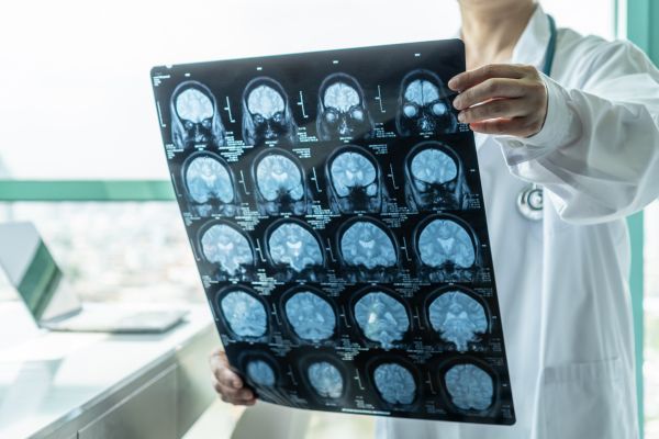 radiologist viewing MRI images of brain